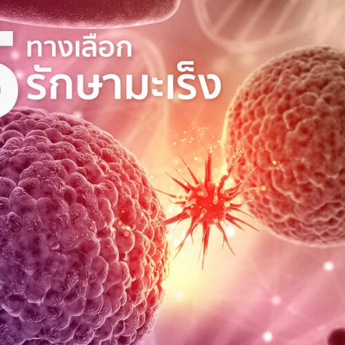 5 ทางเลือกในการรักษามะเร็ง