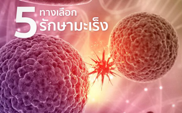 5 ทางเลือกในการรักษามะเร็ง