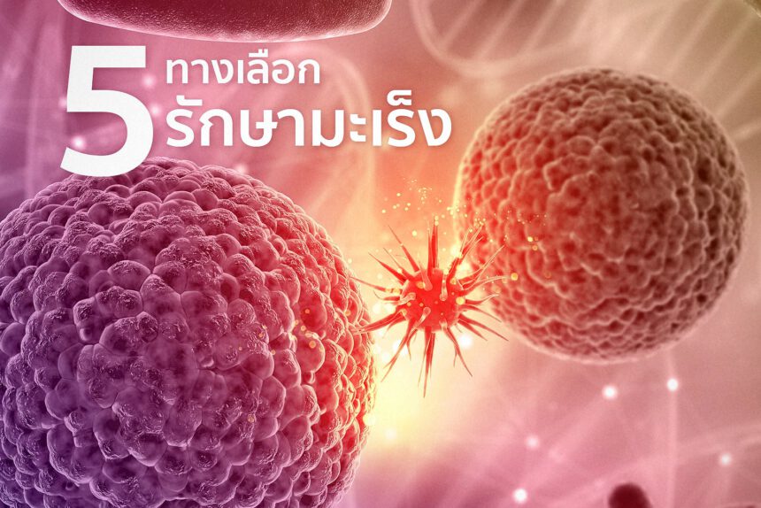 5 ทางเลือกในการรักษามะเร็ง